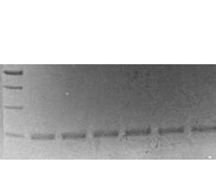 Original unmodified gel: DNA ladder at left and six visible amplified sample lanes
